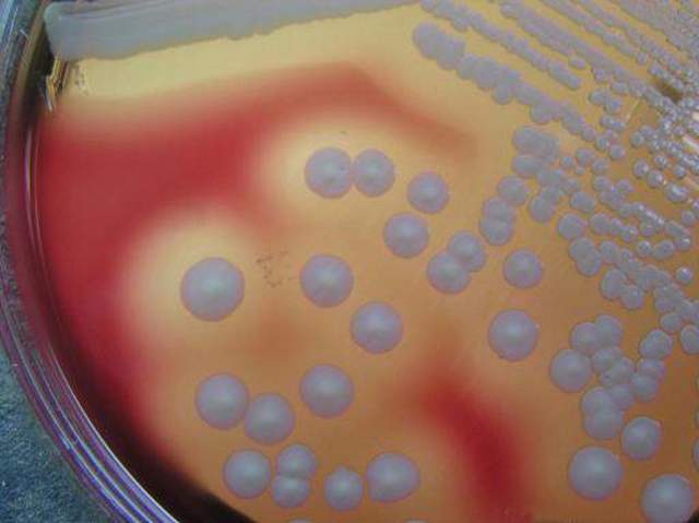 学习体视显微镜采图