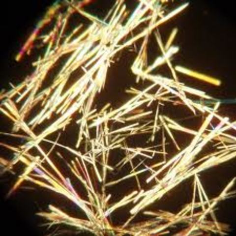 microscopic crystal test