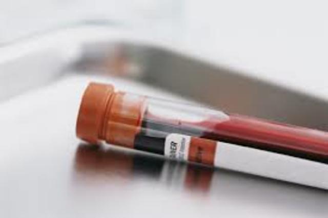 Test for blood