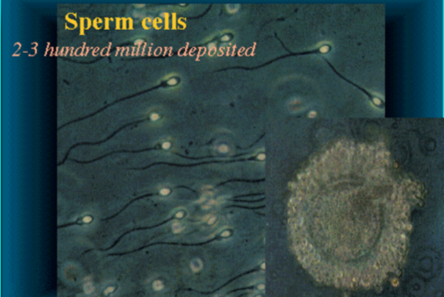 Sperm