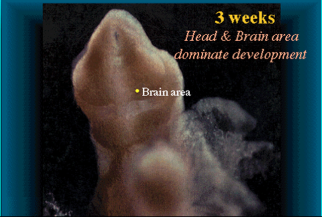 Head and Brain areas develop