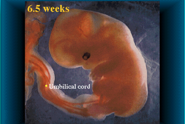 Fetus continue to grow.