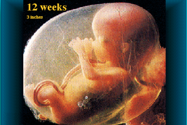 Fetus is 3 inches long