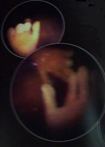 Hands continue to develop