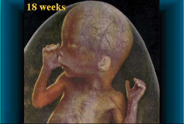 18 weeks of development