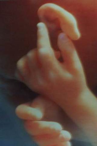 Distinct features are formed