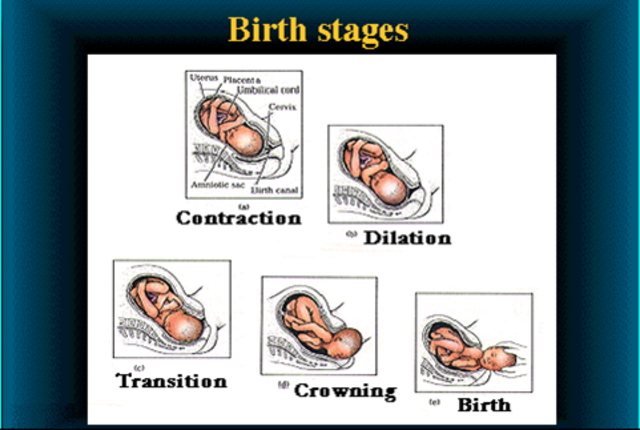 Fully developped child is given birth to