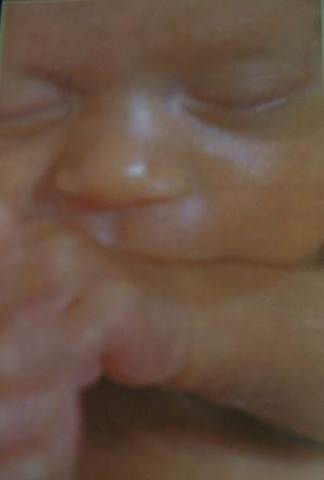 Fully developped child