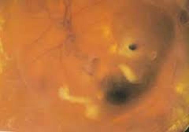 (4 , 5 y 6 semanas ) :