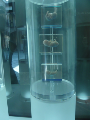 ETAPA FETAL FETO DE 12 SEMANAS