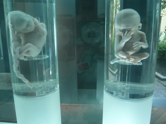 FETO DE 26 A 29 SEMANAS