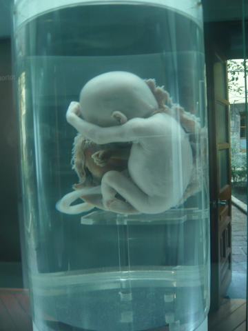 FETO DE 30 A 38 SEMANAS