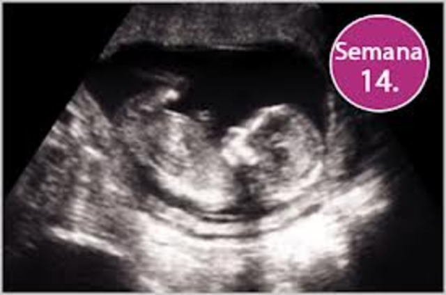 (14 semanas):