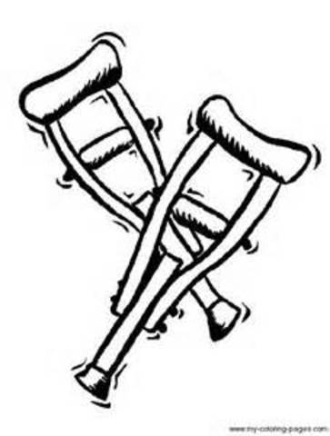 Tore ligaments in my foot