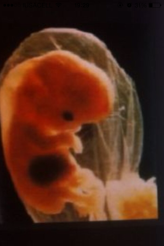 2 SEMANAS DE EMBARAZO