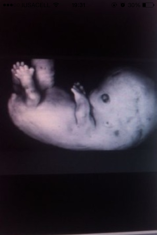 8 SEMANAS DE EMBARAZO