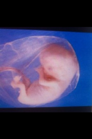 9 SEMANAS DE EMBARAZO