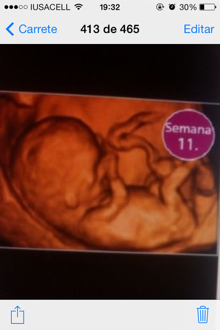 11 SEMANAS DE EMBARAZO