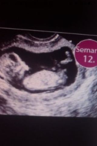 12 SEMANAS DE EMBARAZO