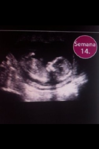 14 SEMANAS DE EMBARAZO