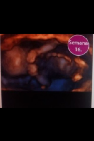 16 SEMANAS DE EMBARAZO