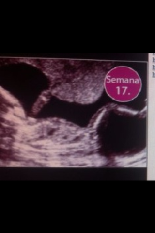 17 SEMANAS DE EMBARAZO