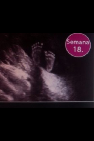 18 SEMANAS DE EMBARAZO