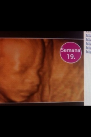 19 SEMANAS DE EMBARAZO
