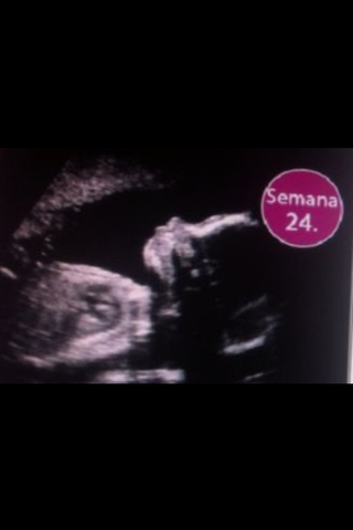 24 SEMANAS DE EMBARAZO