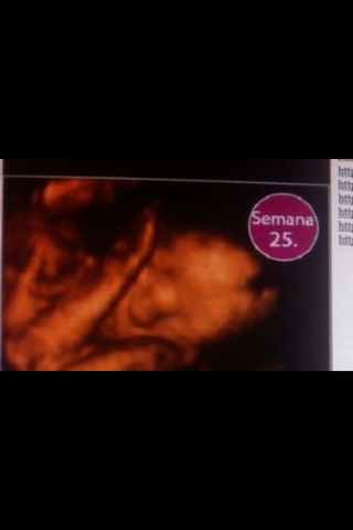 25 DE SEMANAS DE EMBARAZO
