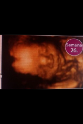 26 SEMANAS DE EMBARAZO