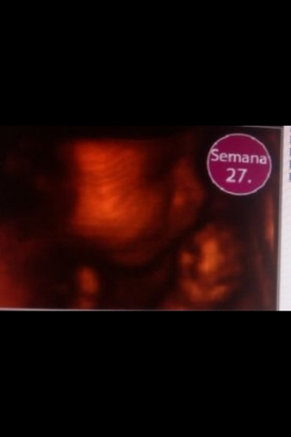 27 SEMANAS DE EMBARAZO