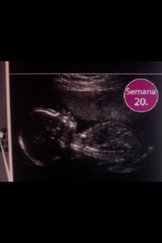 28 SEMANAS DE EMBARAZO