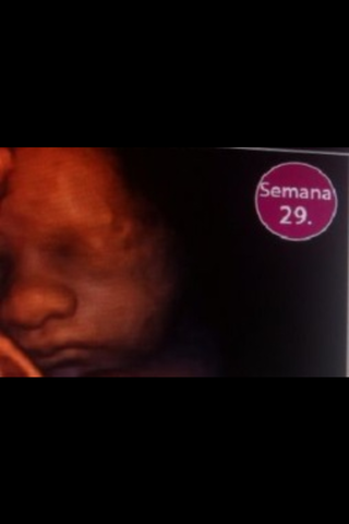 29 SEMANAS DE EMBARAZO