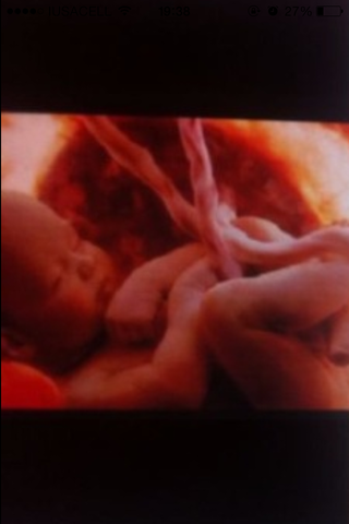 31 SEMANAS DE EMBARAZO