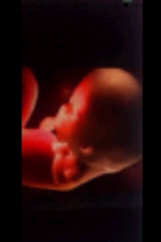 10 SEMANAS DE EMBARAZO