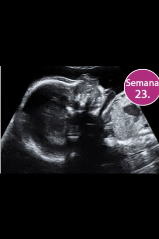 23 SEMANAS DE EMBARAZO
