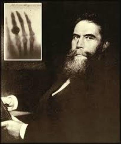 Wilhelm Roentgen and X-Rays