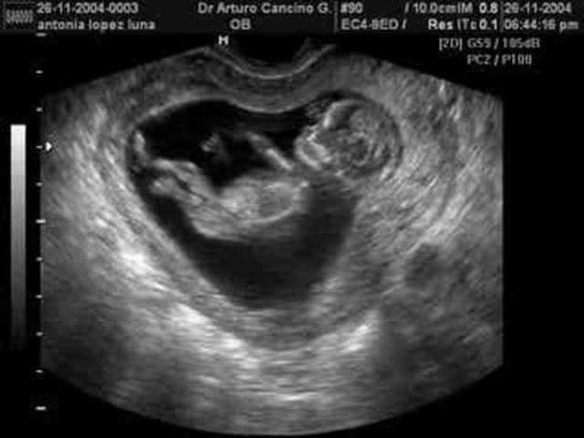 Nacimiento de mi Hermana