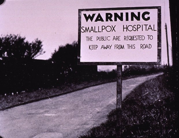 WHO declares smallpox eradicated