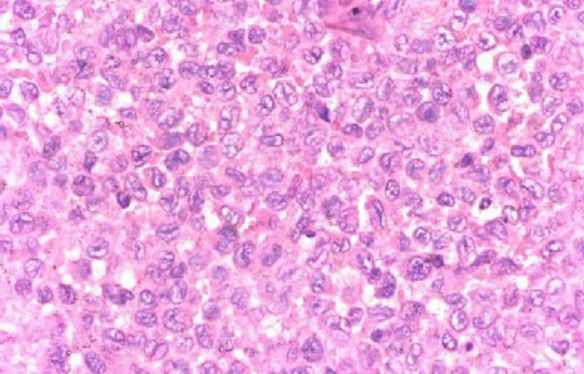 Scientists discover how to use human skin cells to create embryonic stem cells.