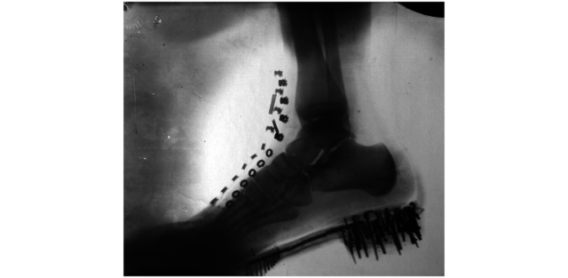 Nikola Tesla Creates X-Ray Photos