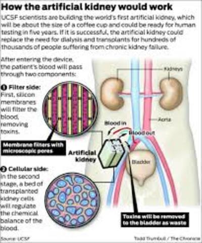 Artificial Kidney