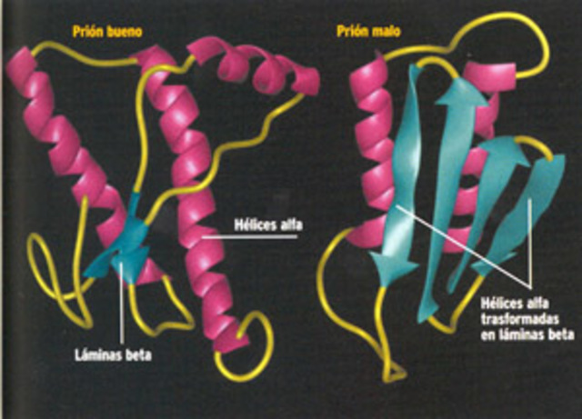 Encefalopatía Espongiforme bovina