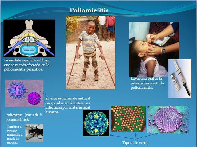 Primera vacuna Contra  poliomielitis