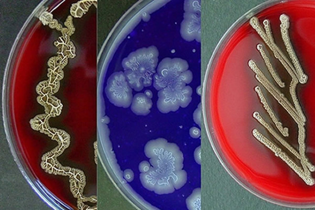 Comceptos de diversidad  de morfologias  poliomielitis