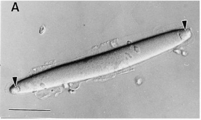 Epulopiscium fishelsoni