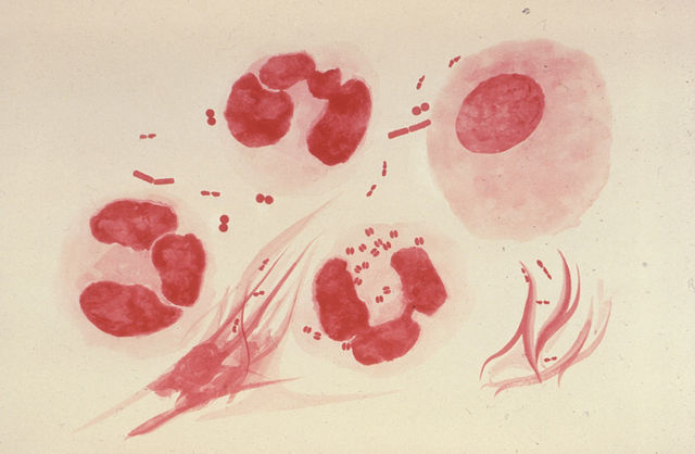 Neisseria Gonorrhoeae