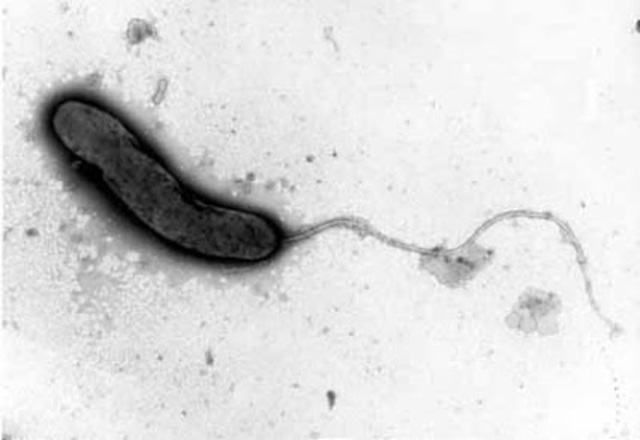 Vibrio cholerae