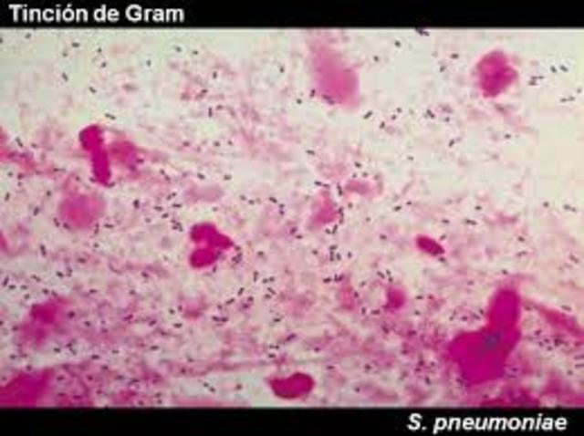 Procedimiento de coloracion de gram